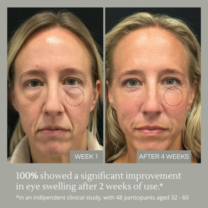 RevitalEyes™️ - Say Goodbye to Puffy Eyes